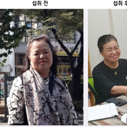 대고LCM 체험사례  – 관절염 및 우울증